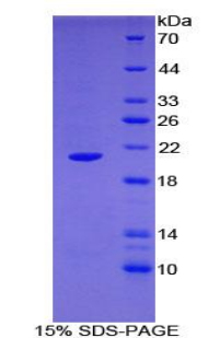 Recombinant Actin Related Protein 2/3 Complex Subunit 4 (ARPC4)