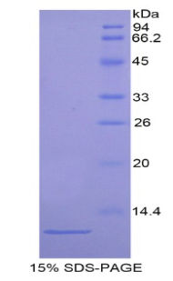 Recombinant Actin Related Protein 2/3 Complex Subunit 4 (ARPC4)