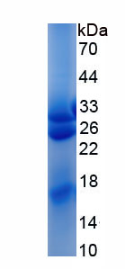 Recombinant Activation Induced Cytidine Deaminase (AICDA)