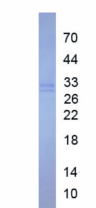Recombinant Apoptotic Chromatin Condensation Inducer 1 (ACIN1)
