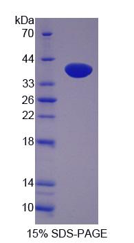 Recombinant LIM And SH3 Protein 1 (LASP1)