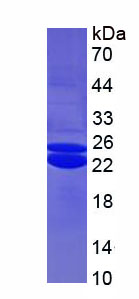 Recombinant Non Metastatic Cells 2, Protein NM23B Expressed In (NME2)