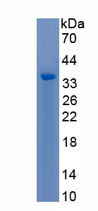 Recombinant Potassium Voltage Gated Channel Shaker Related Subfamily, Member 5 (KCNA5)