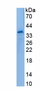 Recombinant Four And A Half LIM Domains Protein 2 (FHL2)