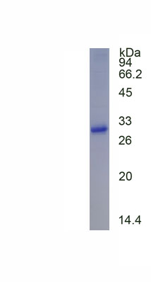 Recombinant Enhancer Of Zeste Homolog 2 (EZH2)