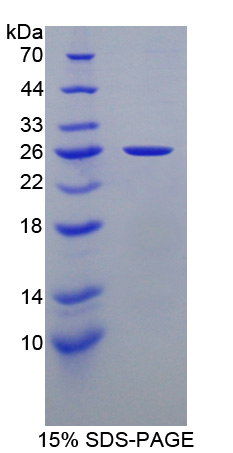 Recombinant Non Metastatic Cells 5, Protein NM23A Expressed In (NME5)