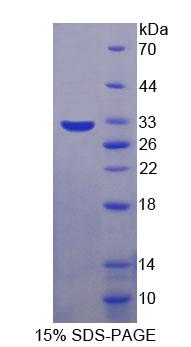 Recombinant Protein Kinase, DNA Activated, Catalytic Polypeptide (PRKDC)