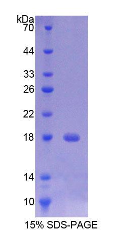Recombinant Transmembrane Protein 27 (TMEM27)