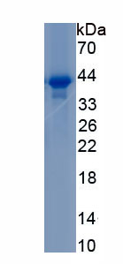 Recombinant DiGeorge Syndrome Critical Region Gene 2 (DGCR2)