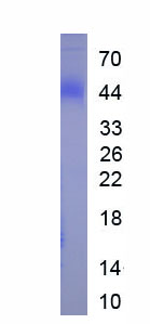 Recombinant FRAS1 Related Extracellular Matrix Protein 1 (FREM1)