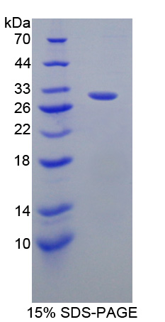Recombinant GRB2 Associated Binding Protein 2 (GAB2)