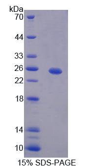 Recombinant Hermansky Pudlak Syndrome Protein 4 (HPS4)