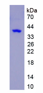 Recombinant Kelch Repeat And BTB Domain Containing Protein 10 (KBTBD10)