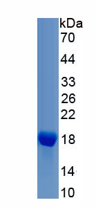 Recombinant Microtubule Associated Protein 1 Light Chain 3 Beta (MAP1LC3b)