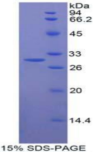 Recombinant Beta-1,3-N-Acetylglucosaminyltransferase Manic Fringe (MFNG)