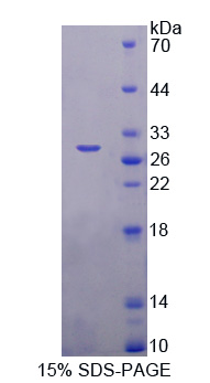 Recombinant Beta-1,3-N-Acetylglucosaminyltransferase Manic Fringe (MFNG)