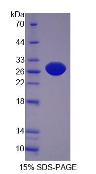 Recombinant Protein L-Isoaspartate-O-Methyltransferase (PCMT1)