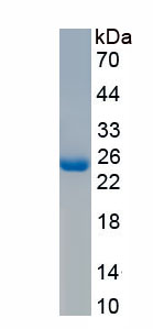 Recombinant PYD And CARD Domain Containing Protein (PYCARD)