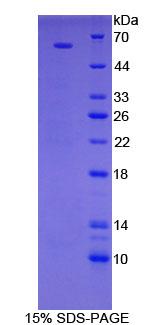 Recombinant Ribosomal Protein S6 Kinase Beta 2 (RPS6Kb2)