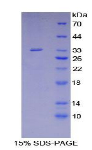 Recombinant Src Homology 2 Domain Containing Adapter Protein B (SHB)