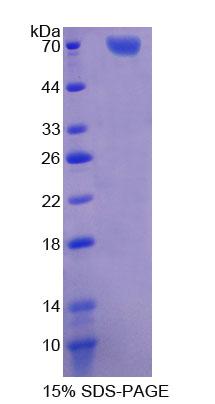 Recombinant Transcription Factor Dp1 (TFDP1)