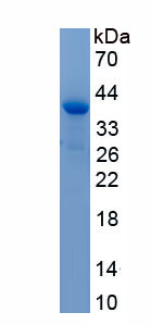 Recombinant BRCA1/BRCA2 Containing Complex Subunit 3 (BRCC3)