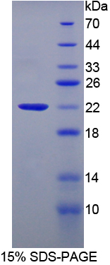 Recombinant Amy1 Associated Protein Expressed In Testis (AAT1)