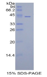 Recombinant Histone Cluster 1, H2aa (HIST1H2AA)