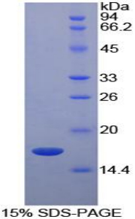 Recombinant Retinol Binding Protein 5, Cellular (RBP5)