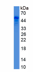 Recombinant RAB27B, Member RAS Oncogene Family (RAB27B)