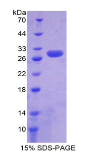 Recombinant Proteasome 26S Subunit, Non ATPase 9 (PSMD9)