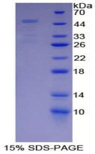 Recombinant Proteasome 26S Subunit, Non ATPase 13 (PSMD13)