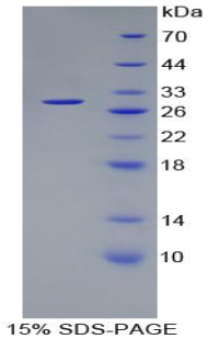 Recombinant Proteasome 26S Subunit, Non ATPase 10 (PSMD10)
