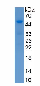 Recombinant Homeobox Protein D9 (HOXD9)