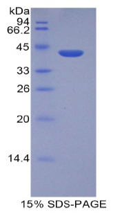 Recombinant Histone Cluster 2, H2aa3 (HIST2H2AA3)