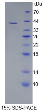 Recombinant Cell Adhesion Molecule With Homology To L1CAM (CHL1)