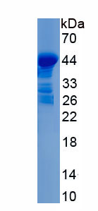 Recombinant Amylase Alpha 2B, Pancreatic (AMY2B)