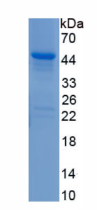 Recombinant Melanoma Antigen Family A3 (MAGEA3)