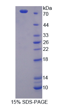 Recombinant Proteasome 26S Subunit, Non ATPase 6 (PSMD6)