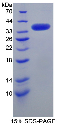 Recombinant SRSF Protein Kinase 3 (SRPK3)
