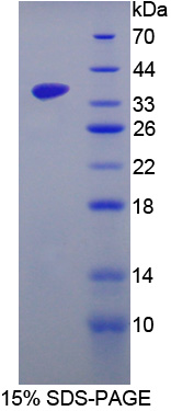 Recombinant SRSF Protein Kinase 3 (SRPK3)