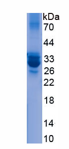 Recombinant Cysteine/Tyrosine Rich Protein 1 (CYYR1)