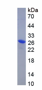 Recombinant Ependymin Related Protein 1 (EPDR1)