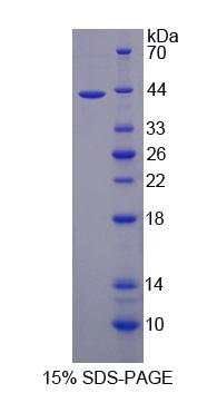 Recombinant Mitochondrial Pyruvate Carrier Protein 1 (MPC1)