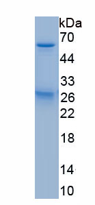 Recombinant Elongation Factor Tu GTP Binding Domain Containing Protein 1 (EFTUD1)