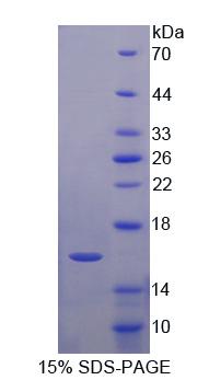 Recombinant LIM And Calponin Homology Domains Containing Protein 1 (LIMCH1)