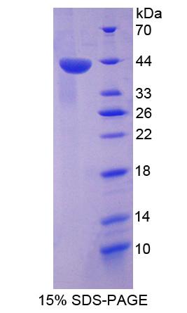 Recombinant TP53 Target Gene 5 (TP53TG5)