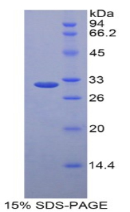 Recombinant Low Density Lipoprotein Receptor Related Protein 5 Like Protein (LRP5L)