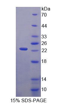 Recombinant Von Willebrand Factor A Domain Containing Protein 5B2 (vWA5B2)