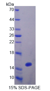 Recombinant Occludin/ELL Domain Containing Protein 1 (OCEL1)